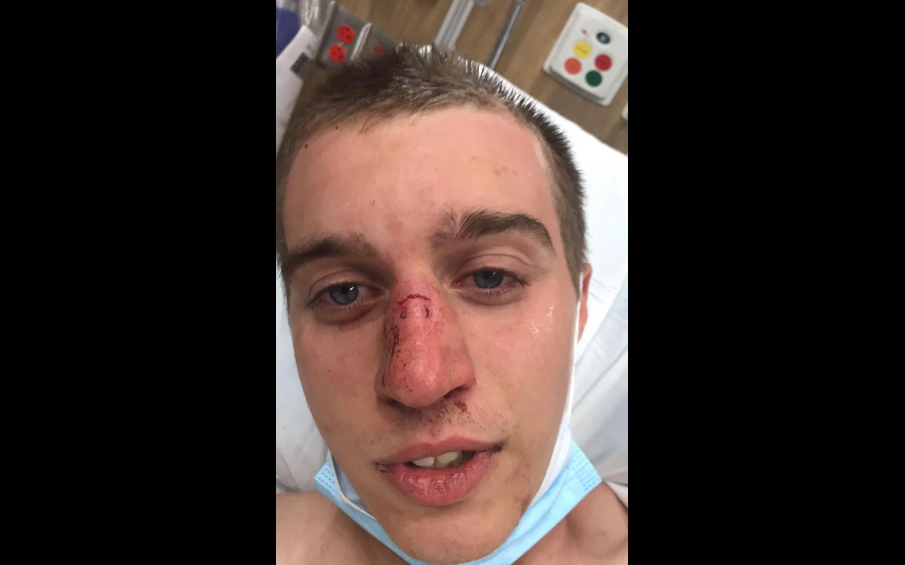 Police Investigating Horrific and Brutal Assault at Carruthers Park in North Tonawanda