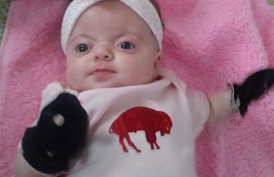 Niagara Falls Family Caring for Baby Born with Rare Disabilities Says Buffalo Bills Gives Them Hope