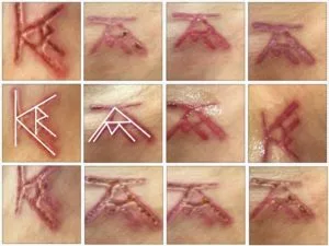 Branding of women by NXIVM