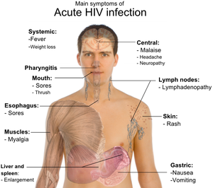 300px-Symptoms_of_acute_HIV_infection